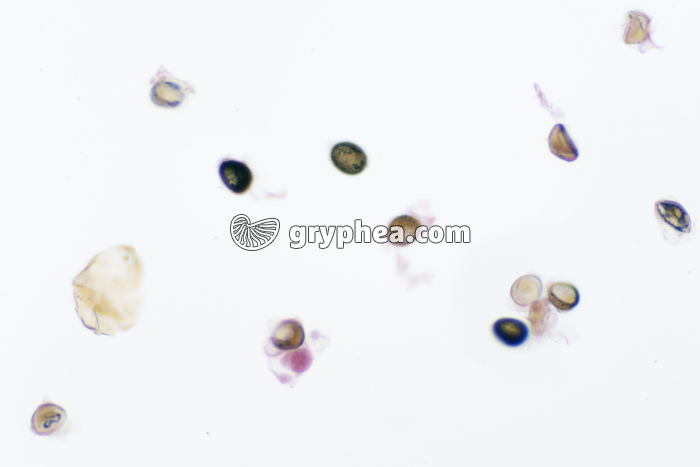 Taenia saginata, oeufs dans déjections x40 - gryphea.org